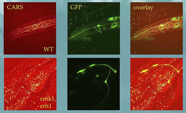 CARS and MPEF imaging of C. Elegans, neuron cells labelled with GFP, lipid droplets revealed with CARS