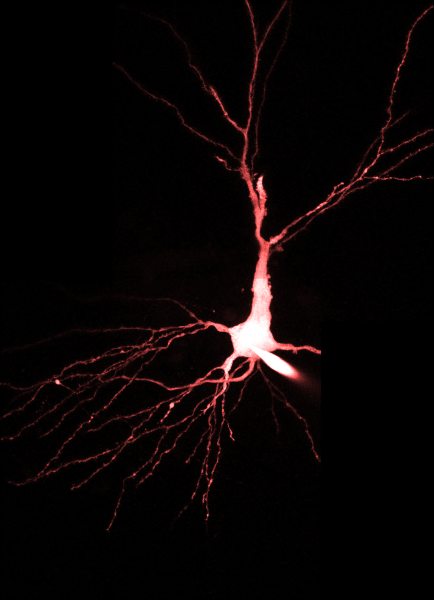Hippocampus CA3 pyramidal neuron; imaged with InSight® DS+™.