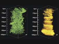 3PF - three-photon fluorescence bio-imaging example