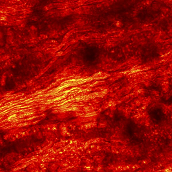 SRS image of spinal cord, pump 802 nm and Stokes at 1040 nm