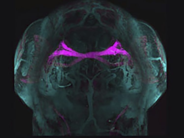 Z-stack of transgenic zebrafish larvae, labeled with GFP and CFP